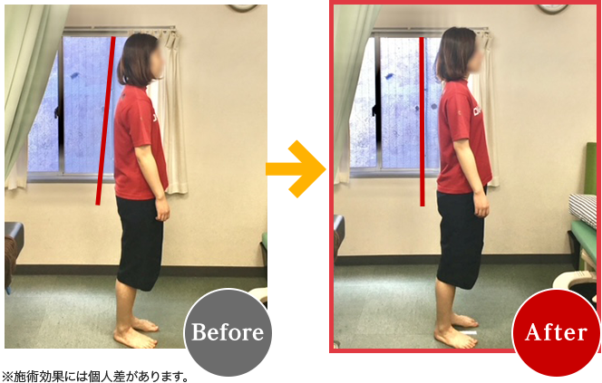 Before After
